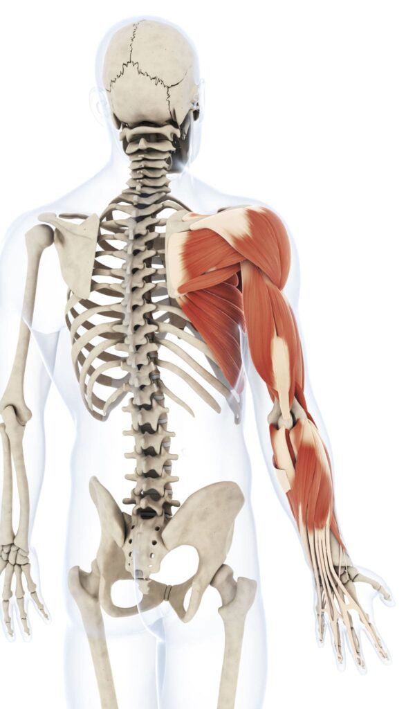 3D model of human skeleton showing the area affected with brachial plexus injury