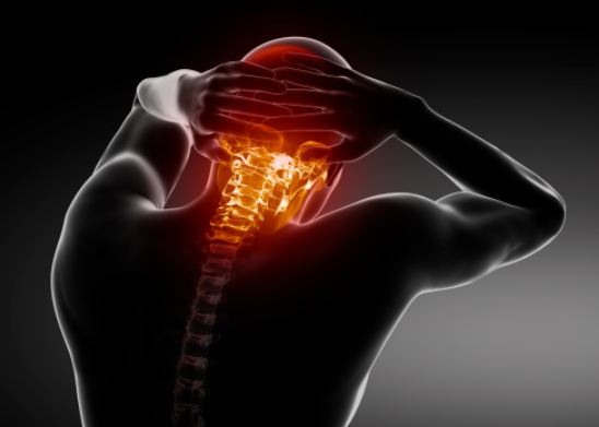 A person showing signs of cervical spinal stenosis