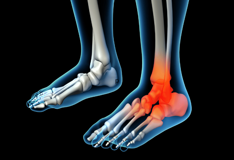 Foot pain due to back injury