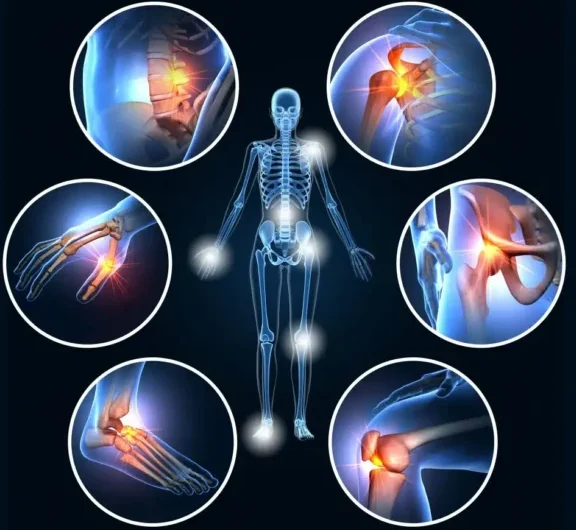 Chronic Pain and Neurological Disorders