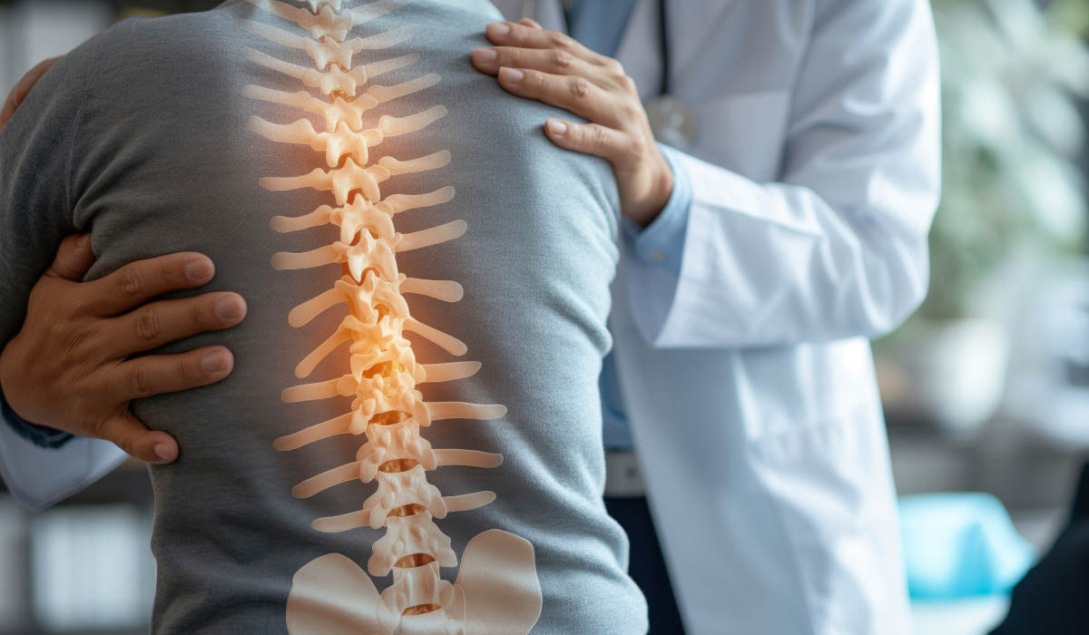 doctor review a spine surgery second opinion x ray.