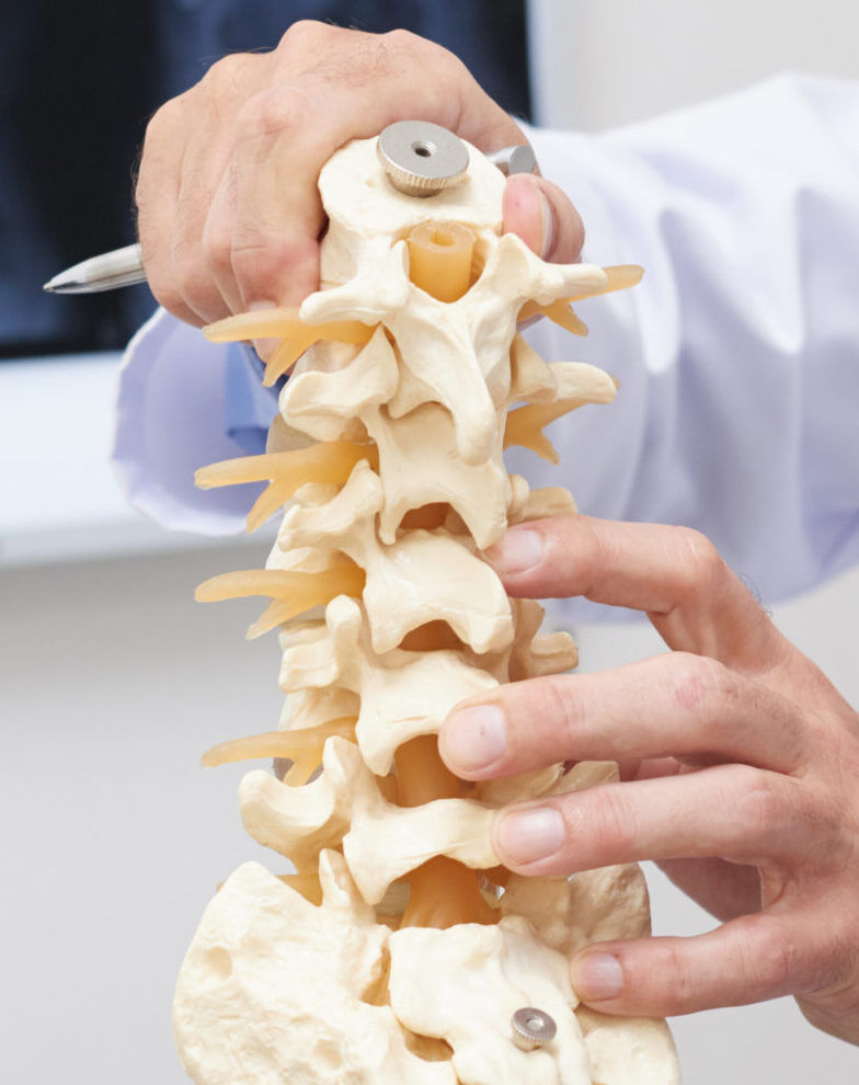 Doctor reviewing MRI image during book virtual second opinion spine appointment.